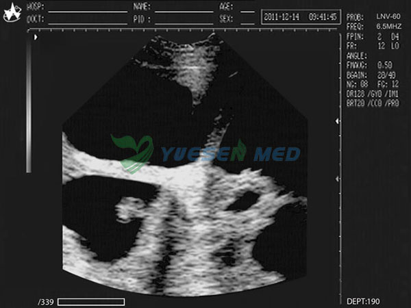 Escáner de ultrasonido veterinario portátil YSB2018V