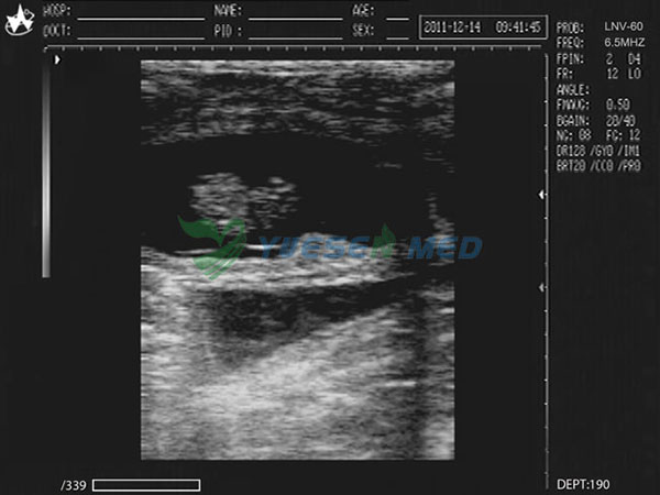 Escáner de ultrasonido veterinario portátil YSB2018V
