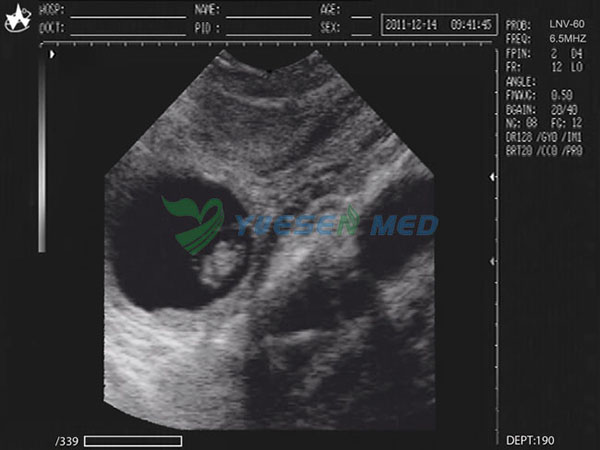 Escáner de ultrasonido veterinario portátil YSB2018V