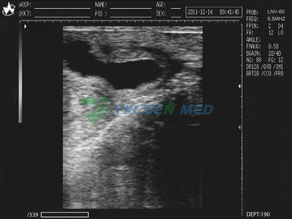 Escáner de ultrasonido veterinario YSVET0210 Imaging